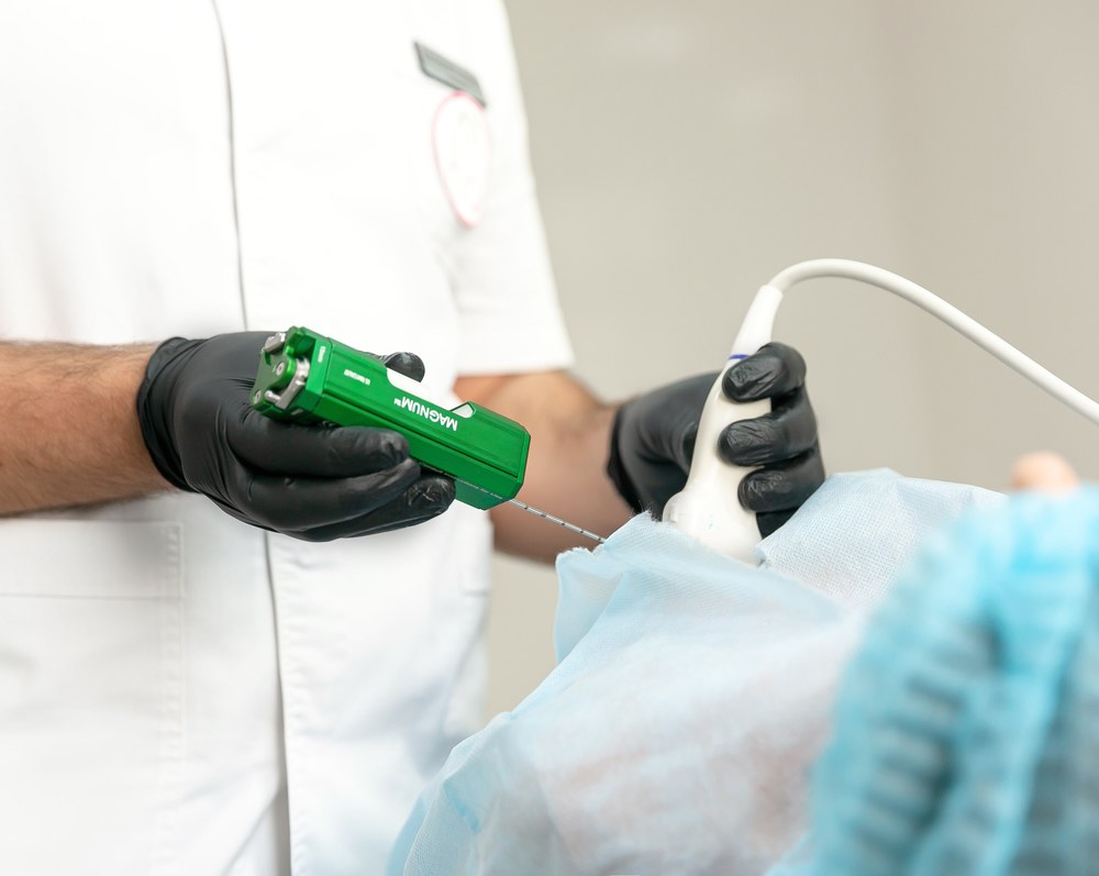 результати біопсії