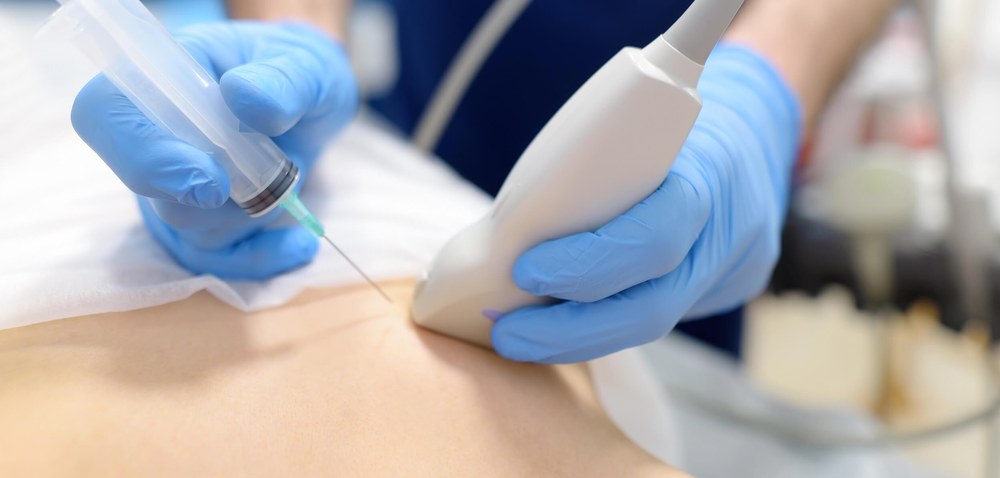 результати біопсії