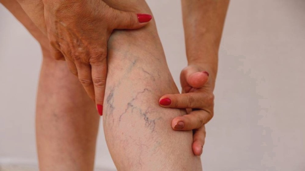 Коли варто звернутись до судинного хірурга